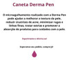 Caneta Derma Pen Microagulhamento Rejuvenescimento Da Pele 5