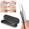 5 X Blackhead Acné Comedones Espinilla Defecto Extractor Rem 0