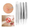 5 X Blackhead Acné Comedones Espinilla Defecto Extractor Rem 1
