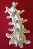 Vértebras Lumbares L1 A L5, Réplica Articulada En Plástico. 4