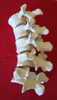 Vértebras Lumbares L1 A L5, Réplica Articulada En Plástico. 5