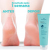 Creme Para Afinar Os Pés Hidrata Tira Ressecados 250g 2