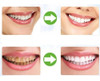Clareador Dente Carvão Pó Ativado 30g 3