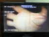 Torre Endoscopia Olympus Cv 140 2