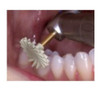 Kit Pulido Para Composite Polishing Easycomp Twist X6 4
