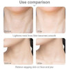 Massageador Facial Anti-rugas Para Lifting De Pescoço 2