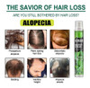 5 Sprays Herbais Essenciais Para O Crescimento Do Cabelo 2