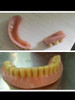 Protesis Dental 5