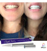 Blanqueamiento Dental Lapiz Blanqueador De Dientes Bright 4 Blanqueamiento Dental Lapiz Blanqueador De Dientes Bright 4