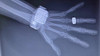 Digitalizador Radiología Veterinaria Funcionando C/ Garantía 1