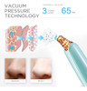 Blackhead Remover Pore Vacuum Cleaner - Limpiador De Poros F 1