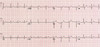 Cable Paciente (10 Deriv) Para Electrocardiografos Comen 3