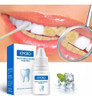Dental Essence Essência De Limpeza, Removedor De Higiene 3