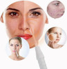 Dispositivos De Alta Frequência Faciais, Máquina Da Terapia 4