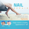 Nail Care Regen Bio-pen Reparação Frágil Eficaz 5pcs 6