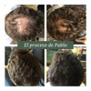 Caída Del Cabello, Anticaída, Recupera Tu Cabello. Fértil 1 Caída Del Cabello, Anticaída, Recupera Tu Cabello. Fértil 1