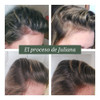 Caída Del Cabello, Anticaída, Recupera Tu Cabello. Fértil 6 Caída Del Cabello, Anticaída, Recupera Tu Cabello. Fértil 6