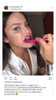 2 Clareamento Dental Melhor Mercado Livre Seguro Eficaz 2