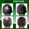 Sérum Capilar Orgânico 3 Regrowth Cuidados Spray 4 Sérum Capilar Orgânico 3 Regrowth Cuidados Spray 4