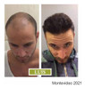 Perdida De Cabello. Anticaida. Caia De Cabello Biotina 6