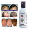 Tratamiento Para Crecimiento Del Cabello - Barba 1 Tratamiento Para Crecimiento Del Cabello - Barba 1