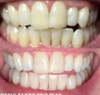 Hismile V34 Pasta De Dientes Blanqueadora 6