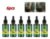 6 Unidades De Óleo De Cabelo Ginger King Nutre Os Folículos 0 6 Unidades De Óleo De Cabelo Ginger King Nutre Os Folículos 0