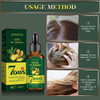 6 Unidades De Óleo De Cabelo Ginger King Nutre Os Folículos 7 6 Unidades De Óleo De Cabelo Ginger King Nutre Os Folículos 7