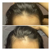 Kit Crescimento Acelerado Grow Fast 1l Shampoo Balm Tônico 3