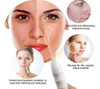 . Máquina De Terapia De Pele, Dispositivos Faciais De Alta 3