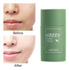 Creme Green Mask Stick Skin Care Tira Acne Espinha Pele 2 Un 0 Creme Green Mask Stick Skin Care Tira Acne Espinha Pele 2 Un 0