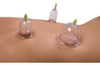 Ventosas Chinas Pistola De Vacio X24 Alivia Dolores Tension Musculo Copas Oferta Nuevas Super Oferta 0 Ventosas Chinas Pistola De Vacio X24 Alivia Dolores Tension Musculo Copas Oferta Nuevas Super Oferta 0
