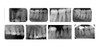 Radiografia Periapical Microcentro Marmen Odontologia 0