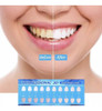 Blanqueador Dental Gel Tratamiento Dientes Blancos White 6