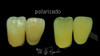 Lente Polarizador Para Movil Quita El Brillo Para Dental 2