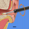 Limpiador Oido Otoscopio Inalámbrico Camara Hd Recargable 7