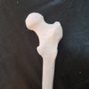 Femur Anatomia Humana Impresion 3d 3