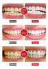 L Creme Dental Probiótico, Clareamento Dentário, Creme 4