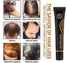 Conjunto De Rolos De Soro De Cabelo Orgânico De Crescimento 2 Conjunto De Rolos De Soro De Cabelo Orgânico De Crescimento 2