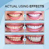 5ml*4pcs De Dentes Instantâneos Tinta De Clareamento 2