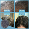 1 Pacote Com 5 Sabonetes De Shampoo Sólido Natural Pure 1