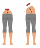 Escoliometro Avaliação Postural Escoliose Fisioterapia 3