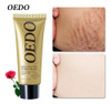 Rose Remove O Creme De Estrias Para Remover O D Pós-parto 0