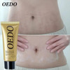 Rose Remove O Creme De Estrias Para Remover O D Pós-parto 3