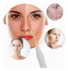 . Aparelho Alta Frequência Facial E Capilar C/4 Eletrodos 4