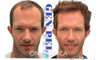 Tratamiento Alopecia La Semilla De Pelo Promo Pack X3 2 Tratamiento Alopecia La Semilla De Pelo Promo Pack X3 2