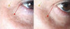 Ultrasonido Masajeador Antiarrugas, Acne Fototerapia 7 Ultrasonido Masajeador Antiarrugas, Acne Fototerapia 7