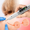 Lapiz Cauterizador De Plasma Para Eliminar Manchas 4