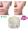 Kit Gel Secativo Acnes + Clareador Facial Marcas De Espinhas 2
