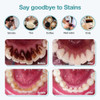 Herramienta De Eliminación De Placa Para Dientes, 1